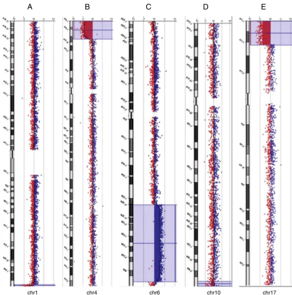 Figure 1 Array-CGH ratio profiles of the chromosomes in four neonates with pathogenic chromosomal imbalances using genomic DNA from the neonates as test (in red) and DNA from normal subjects as reference (in blue)