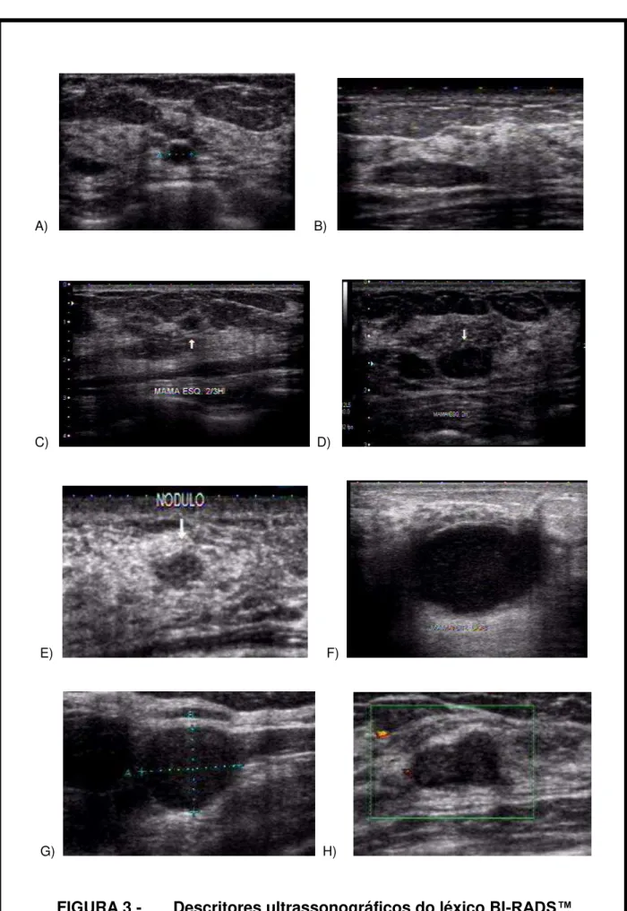 FIGURA 3 -       Descritores ultrassonográficos do léxico BI- RADS™ 