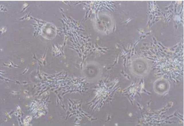 Figura 6  – Colônias de células tronco mesenquimais derivadas de medula óssea.  M.O. Aumento – 60 X