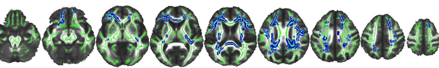 Figure 1. Correlation between white matter integrity and memory 