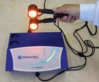 Figure 2 - TcPh device in use, showing the two diodes and a vein identified by transillumination