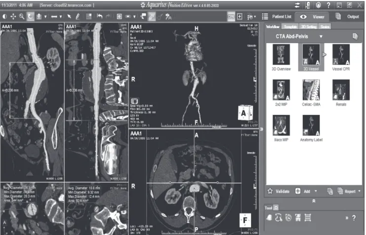 Figura 1. Aspecto da tela inicial do programa iNtuition Cloud da TeraRecon para angiotomografia abdominal.