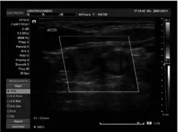 Figure  6.  Doppler  ultrasonography:  common  carotid  artery  near  the  bulb without lesions seven months later.