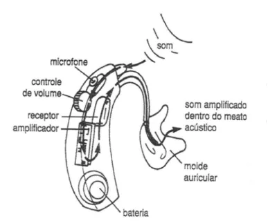 FIGURA 4 - Anatomia básica de uma prótese auditiva retroauricular  Fonte: NORTHERN; DOWNS, 2005, p