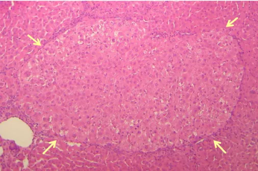 Figura 8 – Fotomicrografia de corte histológico de fígado corado em hematoxilina e eosina de animal submetido  ao  modelo  hepatócito  resistente
