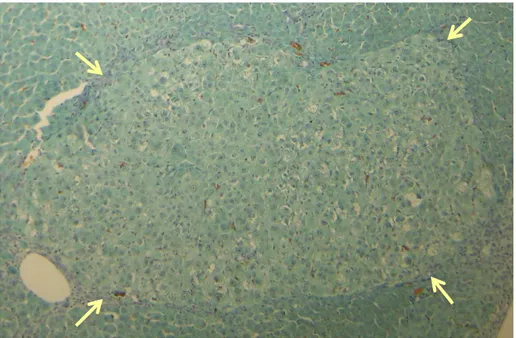 Figura  9  –  Fotomicrografia  de  corte  histológico  de  fígado  corado  por  Shorr  de  animal  submetido  ao  modelo  hepatócito  resistente