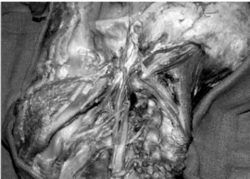 Figure 2. Side view of the external carotid artery branches using the  stereoscopic technique.