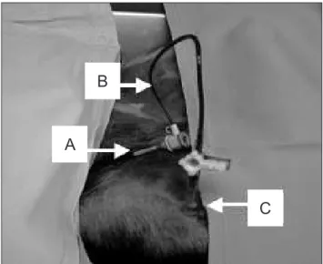 Figure 1. Operation aspect. Catheter (A) inserted in the right external  iliac vein of the dog, irrigation system (B), and cannula (C) placed in the  medullary cavity of the right tibia.
