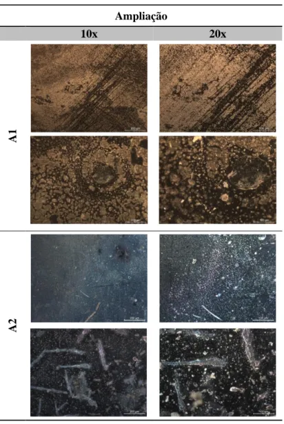 Tabela  3.4.  Imagens  de  microscopia  ótica  obtidas  com  microscópio  de  campo  escuro  evidenciando  áreas deterioradas de A1 e A2