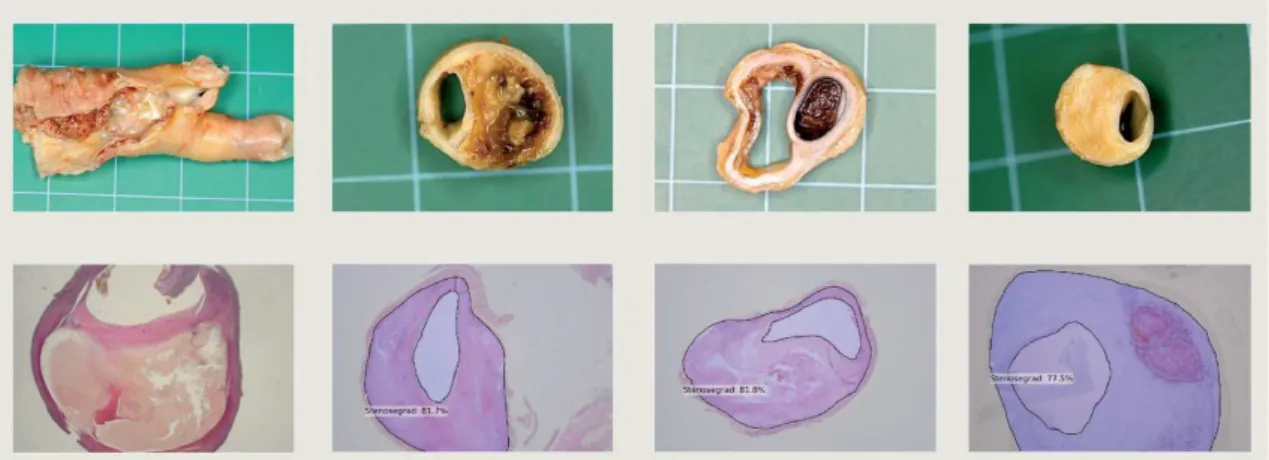 Figure 2. Postoperative aspect and histological cross-sections of specimens.