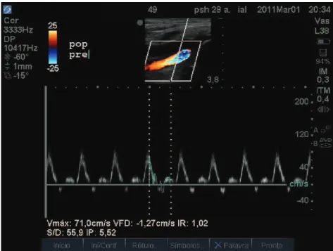 Figure 4. Flow rate analysis in a section of artery close to the osteochondroma.