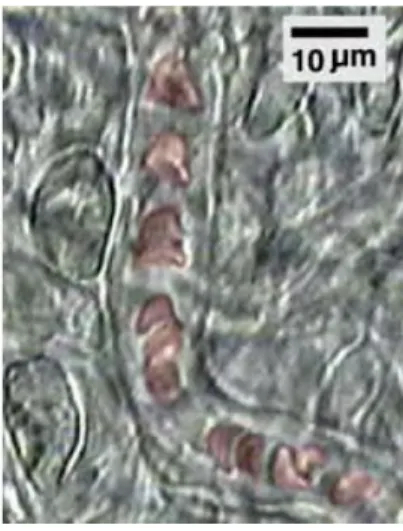 Figura 8 - Deformação in vivo dos glóbulos vermelhos ao longo de um capilar (Minamiyama, 2000)