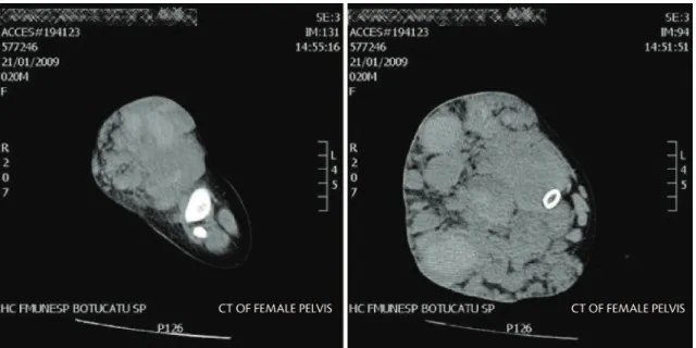 Figure 3. Magnetic resonance images showing lesions.