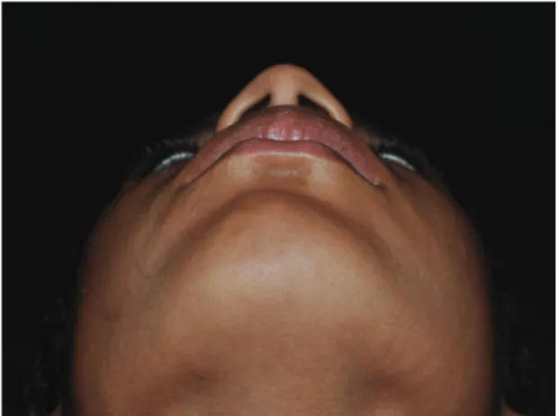 Figure 1. Physical examination, extraoral view.