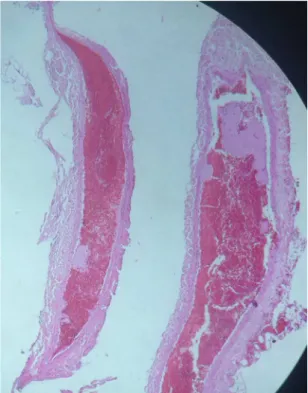 Figure 1. Photomicrograph showing a segment of femoral vein  from a female Wistar rat in which no valves or valve recesses  were identiied.