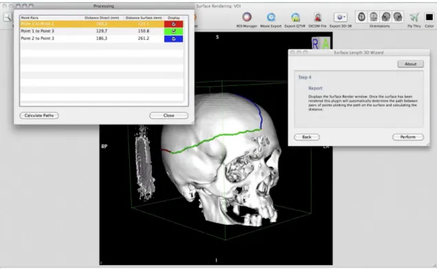 Figure 4. Example application of surface length plugin to measurement of bony structures of the skull.