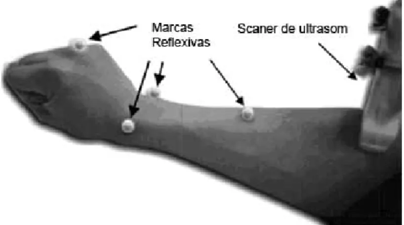 FIGURA 2.15. Posicionamento dos marcadores e do scaner de ultrasom no  antebraço. 