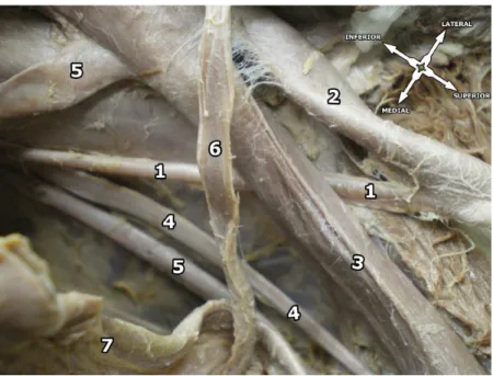 Table 1. Variability pattern of the Obturator artery as proposed  by Sañudo et al. 7