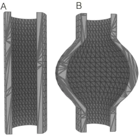 Figure 2. 3D models of (A) cylindrical vein and (B) dilated vein,  showing the increase in internal surface area of the dilated vein.