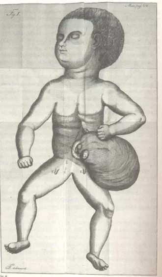 FIG. 1. Ilustração de um feto monstruoso por Francisco Tavares. 