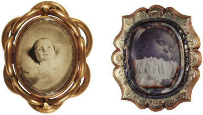 Fig. 8 - Mourning pin, infant with ring curls, c.1870 [The Burns Archive];   Fig. 9 - Gold mourning brooch, daguerreótipo, c.1855 [The Burns Archive].