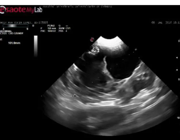 Fig.  2:  Radiografia  abdominal  na  projeção  latero-lateral  com  aumento  da  radiopacidade ventralmente