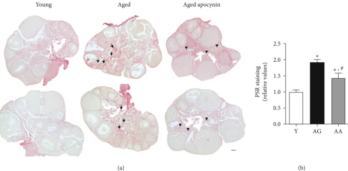 Figure 4: Fibrosis in mouse ovarian midsections stained by picrosirius red. (a) Representative images of young, reproductively aged and apocynin-treated aged mice
