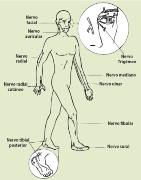 Figura 4: Principais nervos acometidos na pela hanseníase.  