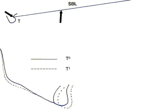 Figure 3 - Mandibular apparent rotation between T 0  and T 1 .  Superimposition on  the SBL at “point T”