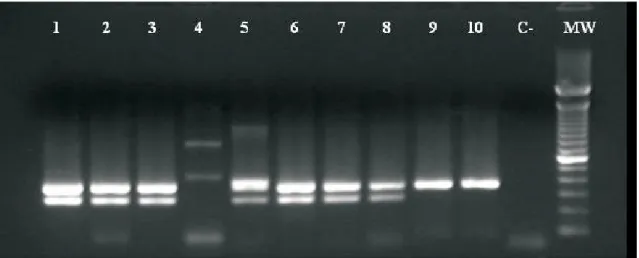 Figura 1 – Eletroforese em gel de agarose dos produtos da PCR amplificados usando  primers  derivados dos genes das PLP 2b e PLP 2x de  S
