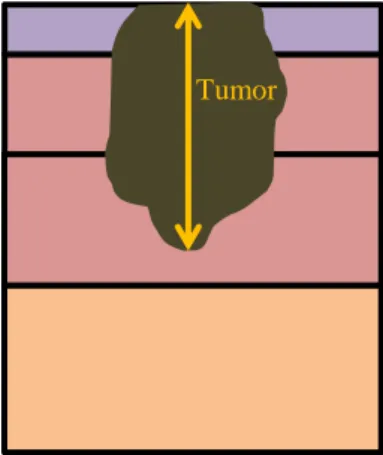 Figure 2: Breslow thickness in mm Tumor