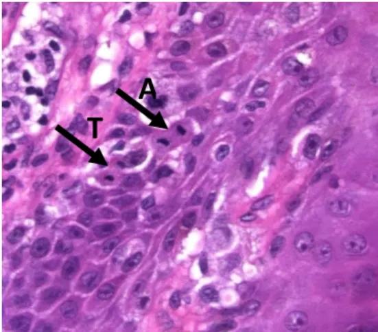 Figure 3: Mitoses in Anaphase (A) &amp; Telophase (T) 
