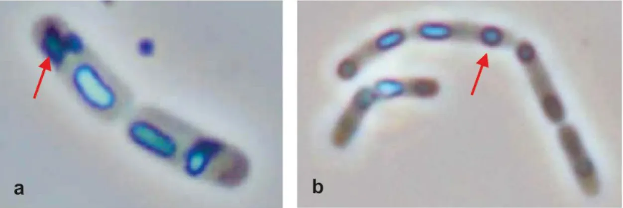 Fig.  1:  Cristais  bipiramidais  de  B. thuringiensis  var.  kurstaki    (a)  e  cristais  esféricos da bactéria B