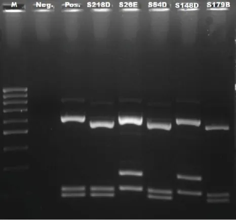 Fig. 3:  Resultado dos perfis de restrição do gene 16S, obtidos por digestão com  AluI  em  gel  de  agarose  a  2%,  para  os  isolados  identificados