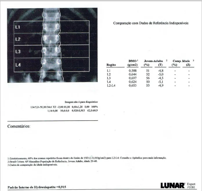 Figura 2  – Exemplo de resultado da densitometria óssea da coluna lombar por DEXA 