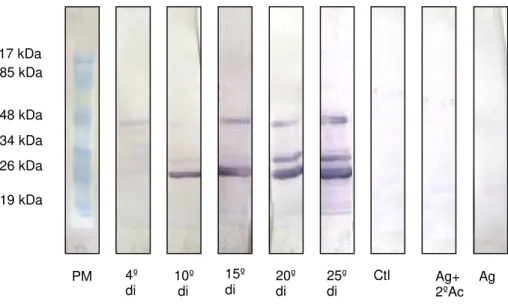 FIGURA  5  -  Western  blot  utilizando como  antígeno secreção e  excreção  de  L 1  com  4 