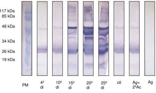 FIGURA 6 -  Western blot  utilizando como antígeno secreção e excreção de L 2  com 10 