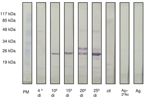 FIGURA  11  -  Western  blot  utilizando  como  antígeno  secreção  e  excreção  de  L 3