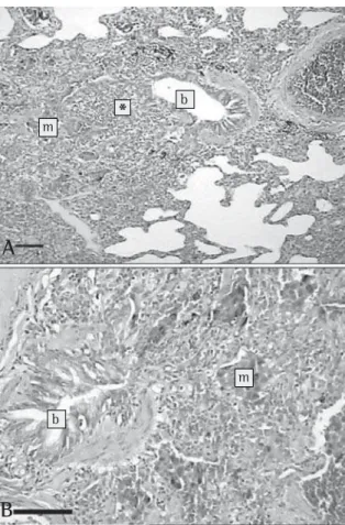 Figure 3 - Optical photomicrographs of pulmonary tissue presenting: A) a constricted bronchiole (b) with partial reduction of the lumen and signs of mild/moderate chronic inflammation in the walls (*), extending to the pulmonary parenchyma; B) Peribronchia