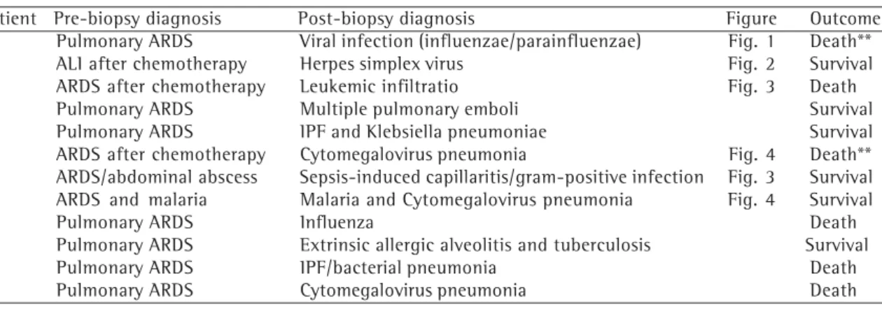 Figure 1 - Diffuse alveolar damage induced by influenzae/