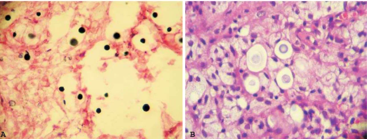 Figure 3 - A) Fungi are stained and therefore clearly visible against the dark background