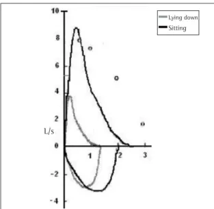Figure 2 - Spirometry in two positions. Flow-volume curve in two positions, sitting and lying down