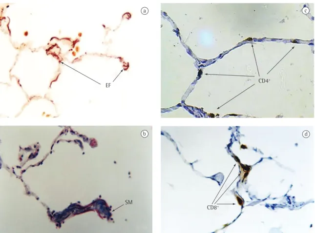 Figure 2), and their linear regression with FEV 1 /FVC  (r 2  = 0.003), smooth muscle fibers (r 2  = 0.006), CD4 + T lymphocytes (r 2  = 0.005) and CD8 +  T lymphocytes  (r 2  = 0.054) demonstrated a weak correlation.