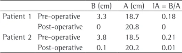 Table  1  shows  the  pre-  and  post-opera- post-opera-tive  measurements  of  the  patients,  together  with  the  respective  indices