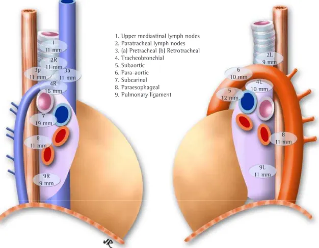 Figure 2 - Map of the mediastinal lymph node stations with the maximum size of the short axis.
