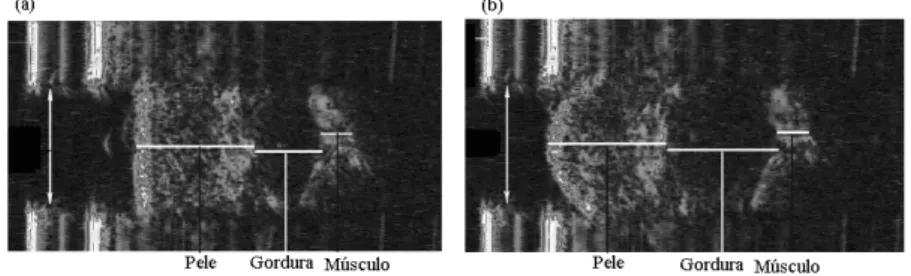 FIGURA 2.26 - Análises de comportamento da pele utilizando imagens de ultra-som (a) antes  do experimento e (b) durante o experimento (HENDRIKS et al., 2003)