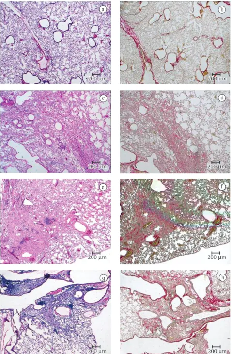 Figure 4 - Photomicrographs of representative lung histological sections of the animals in the studied groups