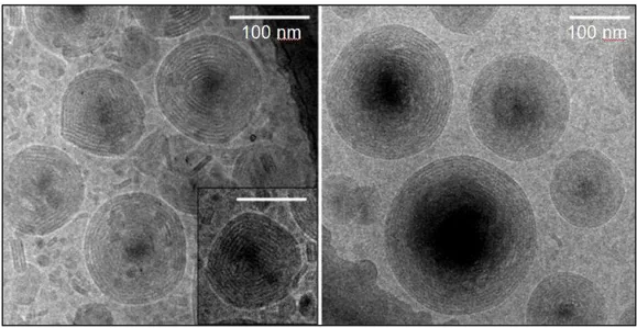 Figura 9 -  Nanopartículas lipídicas sólidas de triestearina vistas em microscopia eletrônica  de transmissão