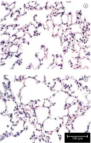 Figure  2  -  Photomicrograph  of  the  lung  of  a  mouse  exposed  to  room  air  only  (a)