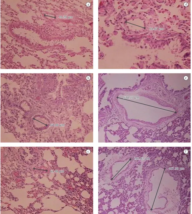 Figure  1  - Photomicrographs of hematoxylin and eosin-stained lung tissue samples: a) control; b) inhaled carbon  tetrachloride;  c)  intraperitoneal  carbon  tetrachloride;  d)  partial  portal  vein  ligation;  e)  and  f)  bile  duct  ligation